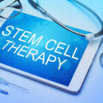 STEM CELL THERAPY scottsdale