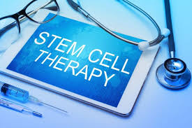 STEM CELL THERAPY scottsdale